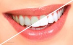 دندان های سفید بدون خمیر دندان