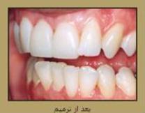 Orthodontics 2