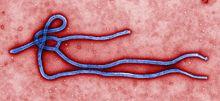 نگاره رنگی‌شده ویروس ابولا