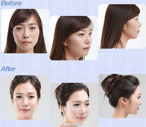 Cosmetic surgery (1)