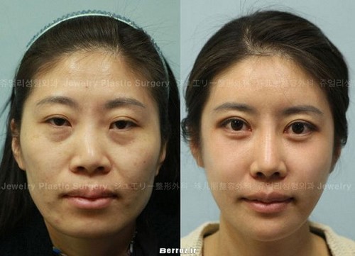 Cosmetic surgery (10)