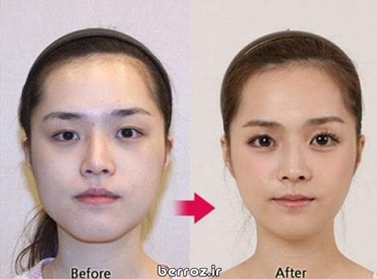 Cosmetic-surgery (10)