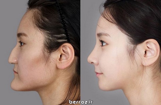 Cosmetic-surgery (11)