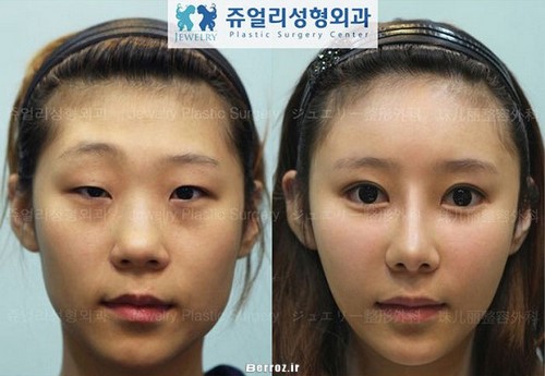 Cosmetic surgery (12)