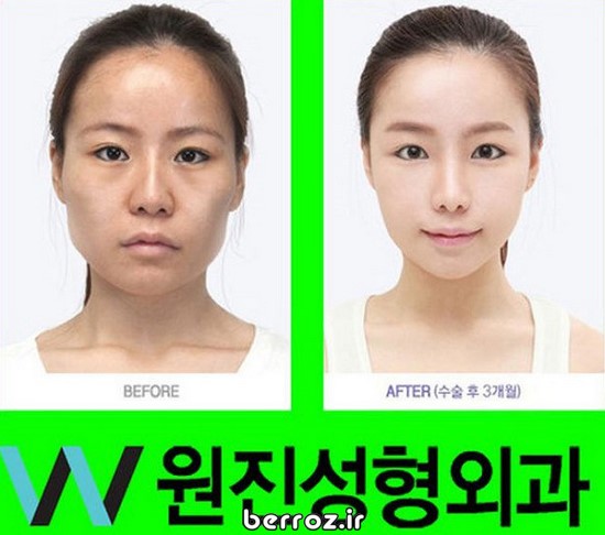 Cosmetic-surgery (13)