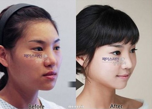 Cosmetic surgery (2)
