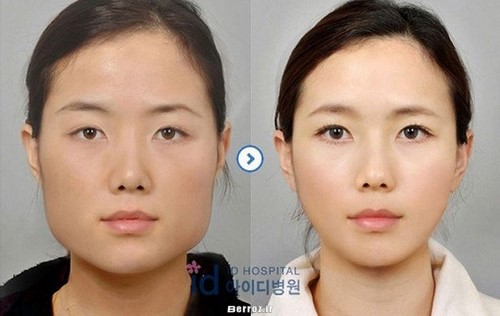 Cosmetic surgery (4)