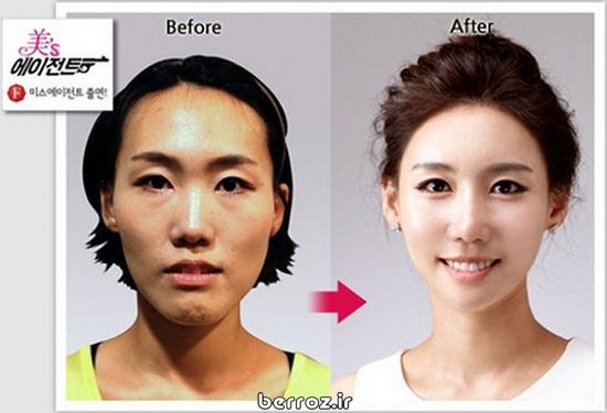 Cosmetic-surgery (4)