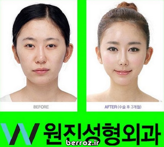 Cosmetic-surgery (5)