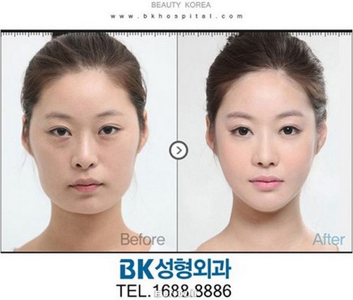 Cosmetic surgery (6)