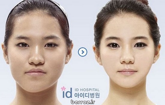 Cosmetic-surgery (7)