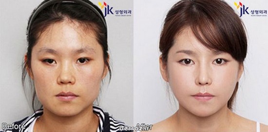 Cosmetic-surgery (8)