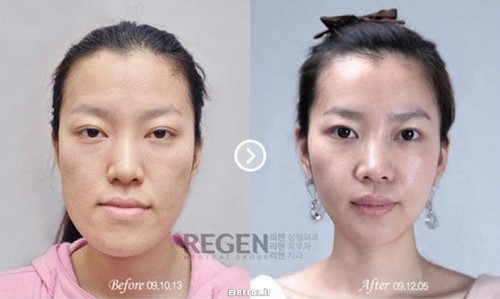Cosmetic surgery (9)