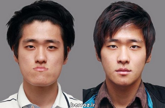 Cosmetic-surgery (9)