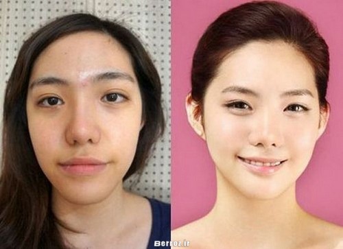 Cosmetic surgery - South Korea (2)