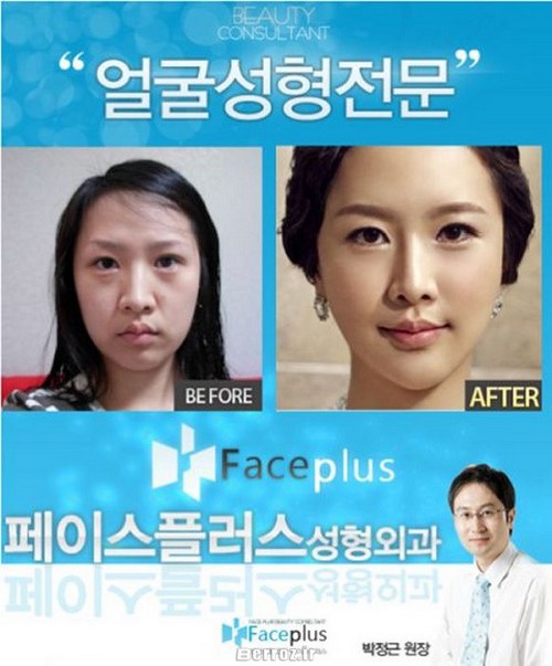 Cosmetic surgery - South Korea (7)