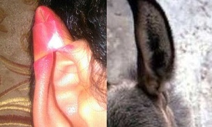 Donkey ear cosmetic surgery (1)