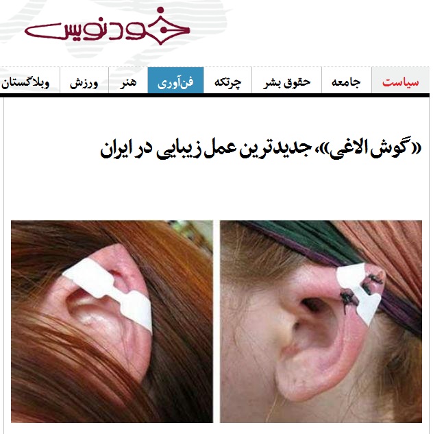 Donkey ear cosmetic surgery (3)