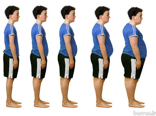 obesity - Overweight